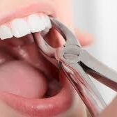 tooth extracted tooth extracted